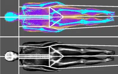 Another DEXA Scan Coming