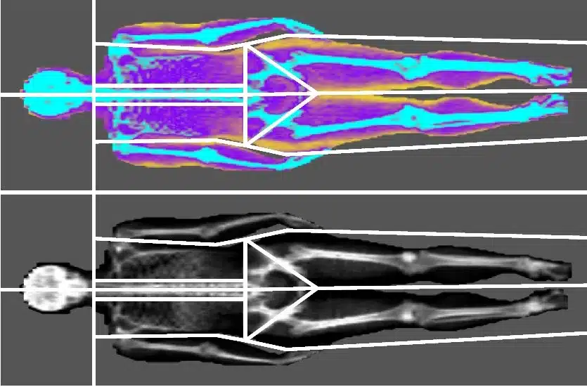 Another DEXA Scan Coming